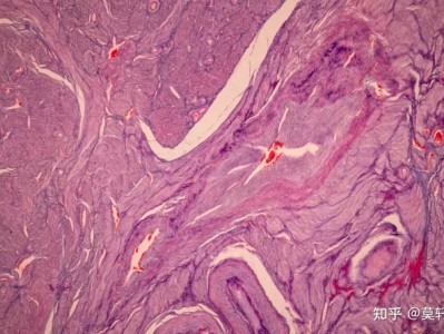 科普丨炖肉时的浮沫，是营养还是脏东西？要不要撇去？